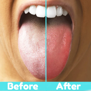 tongue scraper before and after
